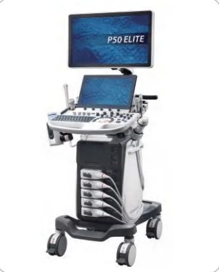 SonoScape P50 Elite Trolley Color Ultrasound