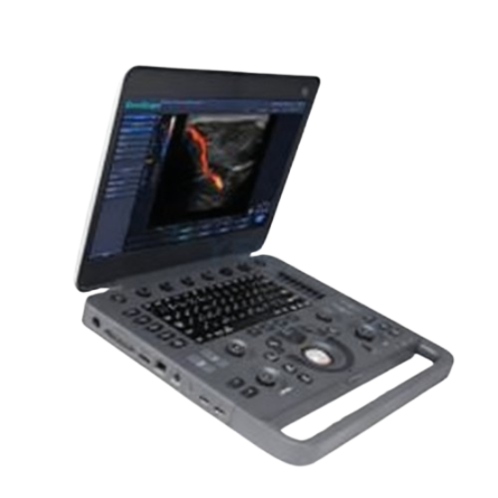 SonoScape X3 Portable Color Ultrasound